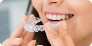 aligners - euro dent clinic